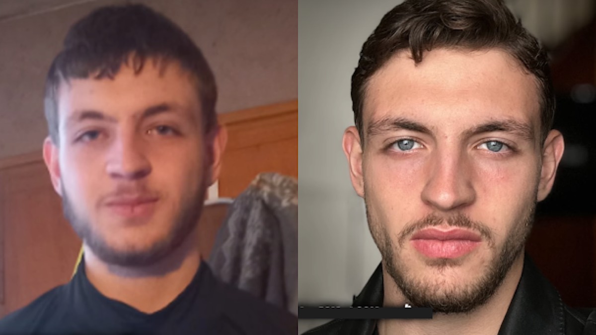 Transformation d'un client, visage avant et après le protocole.