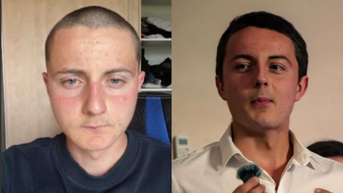 Transformation d'un client, visage avant et après le protocole.