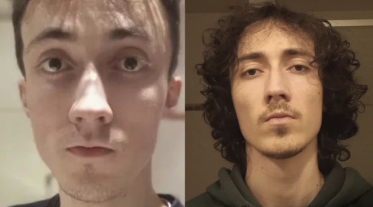 Transformation d'un client, visage avant et après le protocole.